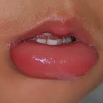 Penyebab dan Cara Mengatasi Bibir yang Alergi